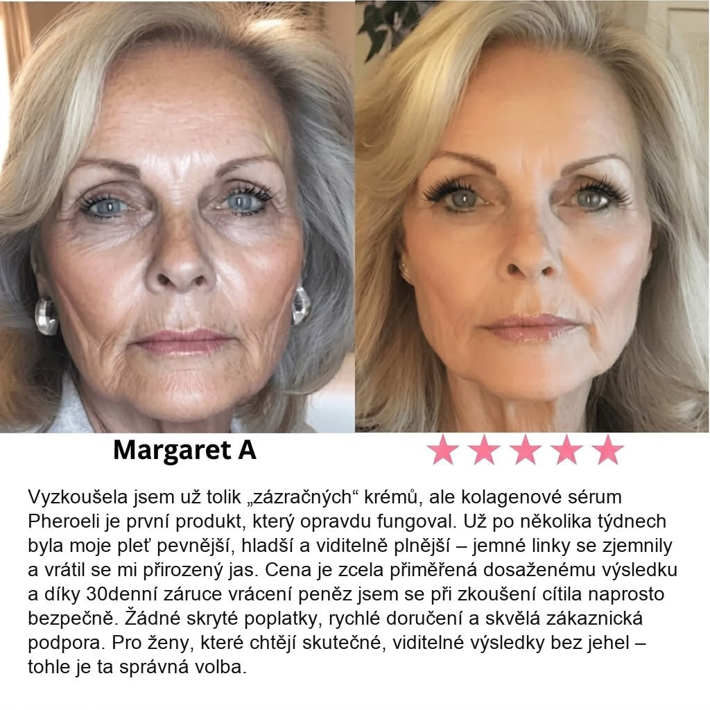 Serum Collagen