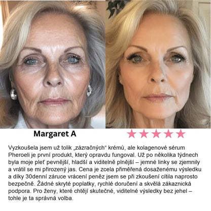 Serum Collagen